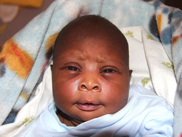 profile_638x479_John_Irungu_pre_op_picture1_AMHF_BKKH_